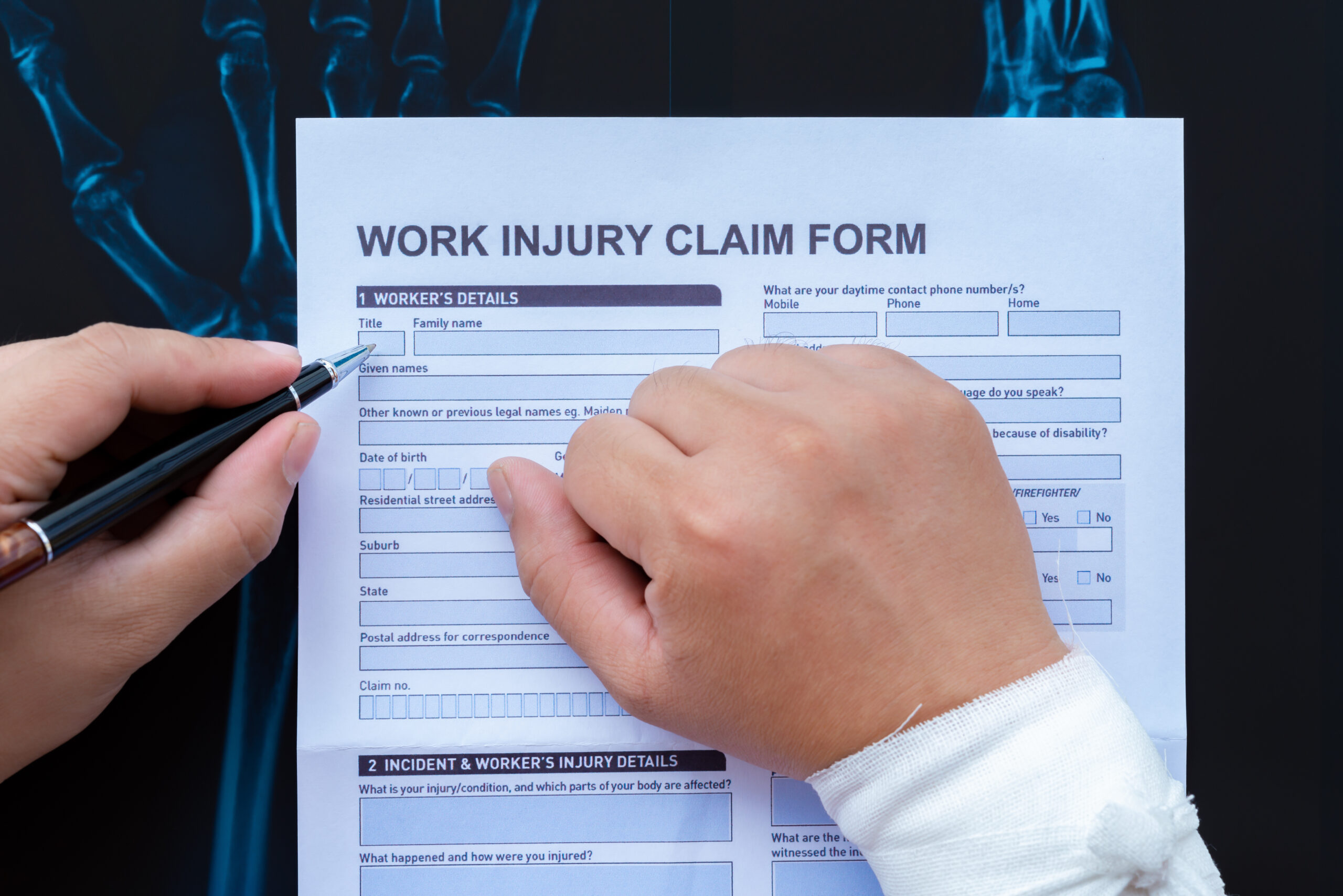 Worker filling out injury claim form with wrapped hand near x-ray